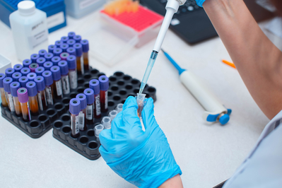 person in a lab running diagnostics on patient's blood